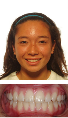before and after